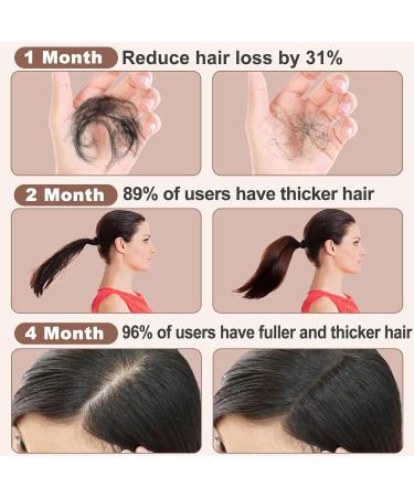 GoldWorld Rosemary Oil for Hair Growth w/Derma Roller Hair Growth Men Women 100ml Light-Weight Non-Greasy Hair Growth Oil Serum Reduce Beard Hair Loss Diluted Rosemary Oil Dry Damaged Hair Tonic - Buy Online on GoSupps.com