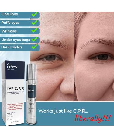 Eye C.P.R: Daily Caffeine & Retinol Under Eye Cream - Anti-Aging Formula for Wrinkles Dark Circles & Puffiness | 30ml - Buy Online on GoSupps.com