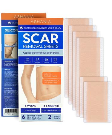  2 sizes sheet Silicone Scar Removal Sheets for Diverse Scars Effective treatment for Old and New Scars 6 Scar Sheets(5.9 x 1.57 2.95 x 1.57)