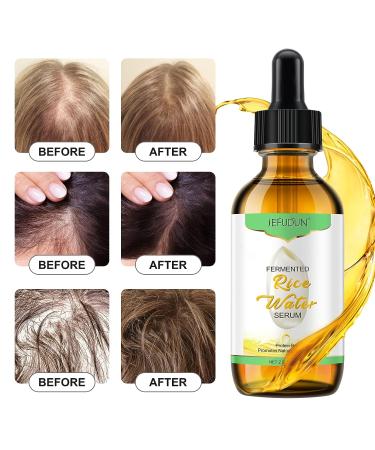 Rice Essential Oil for Hair Growth - 100% Pure Natural Serum for Thin, Damaged Hair - Men & Women - All Hair Types - Buy Online on GoSupps.com