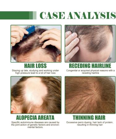 Batana Oil for Hair Growth Hair Care Set with Rosemary Hair Oil & Natural Batana Oil Pure Batana Oil for Healthier Thicker Fuller Hair Prevents Hair Loss & Increases Shine - Buy Online on GoSupps.com
