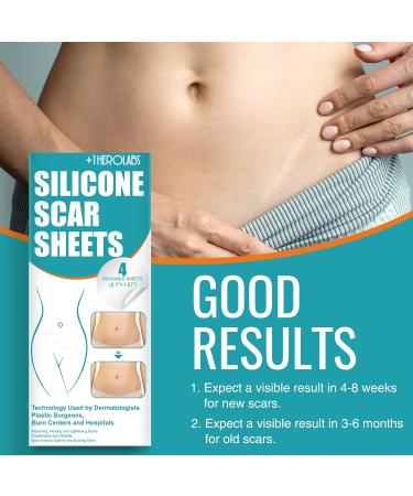Scar Away Extra Strength Silicone Scar Sheets 4 Pack - Reusable Medical Grade Treatment for C-Section, Keloid, Surgery, Injury, and Burns - 5.7x1.57 inches - Buy Online on GoSupps.com