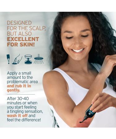 Psoriasis Treatment Serum with Salicylic Acid - Relieve Dry, Itchy Scalp & Skin Conditions - 1.7 fl. Oz - Buy Online on GoSupps.com