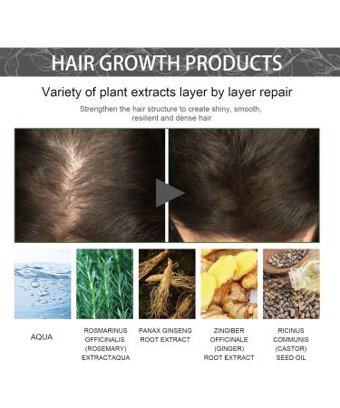 Hair Growth Serum Anti Hair Loss Hair Serum Rosemary Essential Oil With Ginseng And Castor Oil Extracts Repairs Hair Follicles Stronger Hair Hair Growth Oil for Women & Men 35ml - Buy Online on GoSupps.com