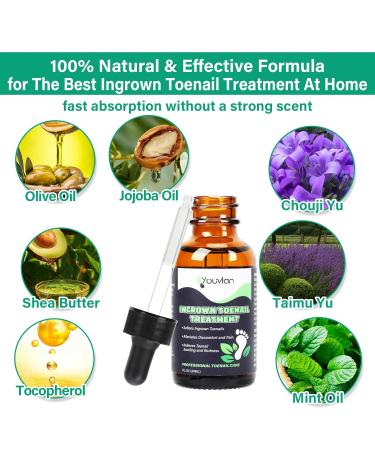 Ingrown Toenail Treatment Kit - Softener Drops Lifter Nail Patches & Tools for Easy Home Care - Buy Online on GoSupps.com