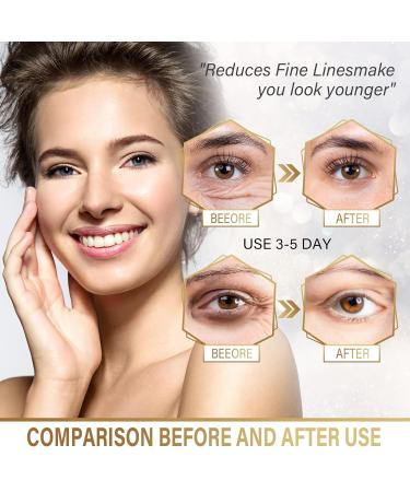 24K Gold Under Eye Masks - 30 Pairs Collagen Gel Patches for Dark Circles Puffiness & Fine Lines - International Shipping Available - Buy Online on GoSupps.com