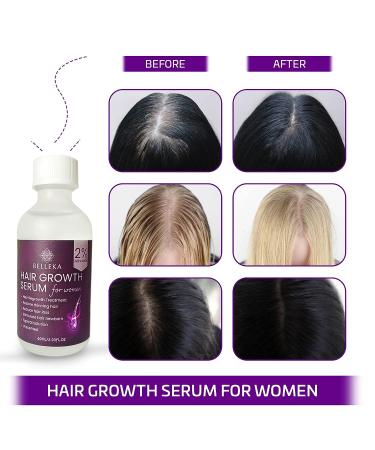 Belleka Minoxidil for Women 2% Hair Growth Serum - Thinning Hair Treatment - Regrow, Strengthen, and Thicken Hair - Stop Hair Loss - 60ml - Buy Online on GoSupps.com