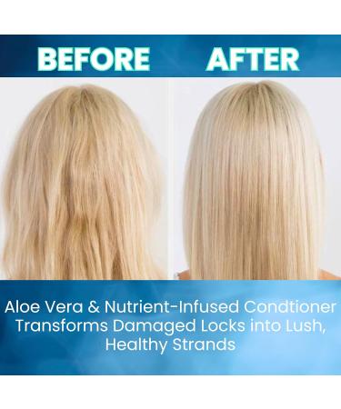 Aloe Organic Hair Conditioner - Deep Hydration Frizz Control & Damage Repair for All Hair Types - Promotes Healthy Growth - International Shipping Available - Buy Online on GoSupps.com