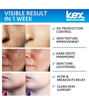 Glycolic Peel Pads - Natural Exfoliating Pads with Vitamins B5 C E & Green Tea | Anti-Aging Acne Control Brighter Skin - Shop Internationally - Buy Online on GoSupps.com