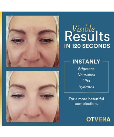 High-Quality Anti-Aging Eye Cream - Wrinkle & Dark Circle Remover (8ml) - Buy Online on GoSupps.com