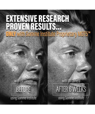 Exfoliating Glycolic Acid Pads | Anti-Aging Smoothing Resurfacing | Somme Institute Transport Alcohol-Free Brightening for Gentle Dirt Removal and Pore Cleansing | 50 Ct. Chamomile Green Tea 50 Count (Pack of 1) - Buy Online on GoSupps.com