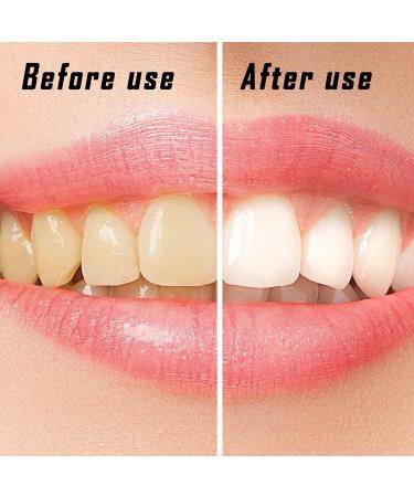 Homury Tooth Sandpaper & Polishing Set - 60 Pieces for Deep Cleaning & Oral Hygiene - Buy Online on GoSupps.com