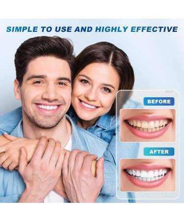 Teeth Whitening Kit | 32X LED Light & Gel Pen | Non-Sensitive Tooth Whitener - Portable Waterproof Professional Oral Care Tools - Buy Online on GoSupps.com