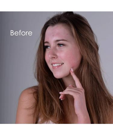 Nature Spell Activated Charcoal & Honey Purifying Face Mask 100 ml With Vitamin E Helps Remove Acne Unclog Pores & Dead Skin Cells - Made In The UK - Buy Online on GoSupps.com