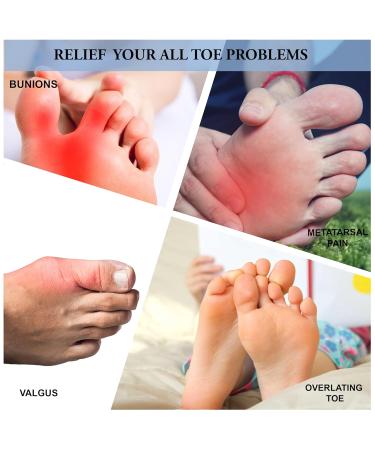 Buy Wonder Care Silicone Toe Separator - Gel Toe Pads Bunion Corrector & Hammer Toe Straightener - Comfortable One Size White Pair for Yoga & Foot Pain Relief - International Shipping Available - Buy Online on GoSupps.com