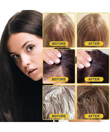 EXQST Suki-Bay Rice Water Advanced Serum Rice Water Hair Serum Hair Oil for Dry Damaged Hair and Growth - Buy Online on GoSupps.com
