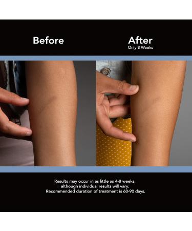 ScarAway Advanced Silicone Scar Sheets - 12 Reusable Sheets for Body, Surgical, Burn, Acne, & Keloid Scars - Buy Online on GoSupps.com