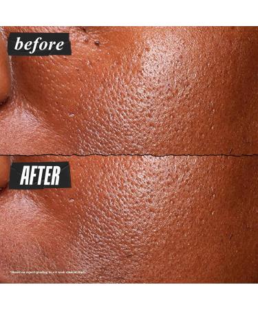 Kiehl's Ultra Pure Niacinamide Serum 5% - High-Potency Oily Skin Concentrate Reduces Shine & Imperfections Paraben-Free 1 fl oz - International Shipping Available - Buy Online on GoSupps.com