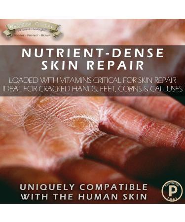 BALM OF GILEAD Manuka Eczema Honey Cream - Tea Tree Balm -Moisturizer for Sensitive Skin Eczema Psoriasis Dermatitis - Softens Skin Irritations Balm for Eczema Rashes Dry Skin - Buy Online on GoSupps.com