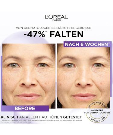 L'Or al Paris Revitalift Filler Facial Care Set - Anti-Aging Serum & Eye Serum with Hyaluronic Acid Vitamin C & Caffeine for All Skin Types - Buy Online on GoSupps.com