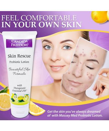 Massey s Skin Rescue Probiotics Lotion - Daily Non-Greasy Hydrating Lotion for Men & Women - Refreshing Lemon Scent - Smooth Sensitive Skin - 3.4 oz - International Shipping Available - Buy Online on GoSupps.com