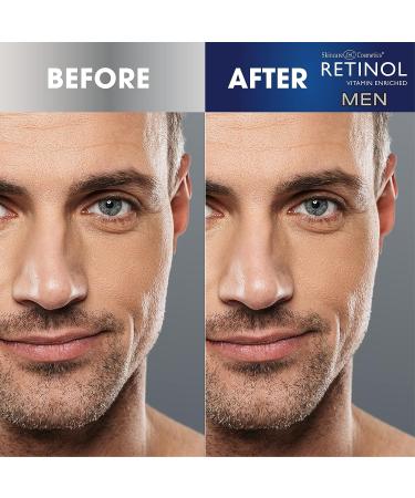 Men's Retinol Daily Moisturizer | Anti-Aging Benefits & Deep Hydration for Younger-Looking Skin - Buy Online on GoSupps.com