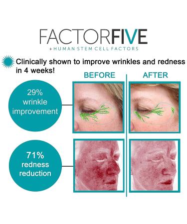 FACTORFIVE Age Defying Cream | Stem Cell Growth Factors | Anti-Wrinkle & Acne Scar Repair | Large 1fl oz - Buy Online on GoSupps.com