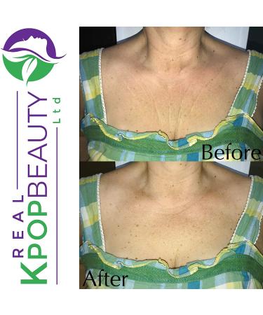 Real Kpopbeauty Anti Wrinkle Chest Pads - Set of 2 | Medical Grade Silicone Decollete Pads for Wrinkle Reduction - Buy Online on GoSupps.com