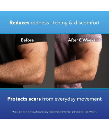 ScarAway Advanced Silicone Scar Sheets - Medical Grade Treatment for Surgical, Burn, Acne & Body Scars - 4 Tan Reusable Strips - Buy Online on GoSupps.com