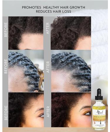 Aravenel Hair Follicle Stimulator: 2Fl Oz Hair Growth Oil Rich in Vitamins, Grape Seed Oil & Hemp Oil Serum for Scalp - Stimulates Regrowth - Buy Online on GoSupps.com