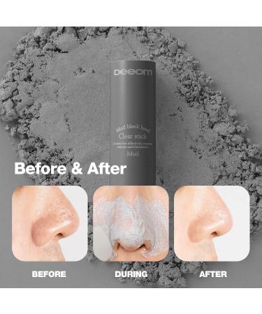 DEEOM Blackhead Remover Stick Deep Pore Cleansing Charcoal Stick for Blackheads & Whiteheads Exfoliating Pore Cleanser Oil & Sebum Control 14g - Buy Online on GoSupps.com
