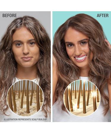 Neutrogena Gentle & Soft Healthy Scalp Shampoo - Sensitive Scalp, Lightweight Moisture, pH-Balanced, Color-Safe - 12oz - Buy Online on GoSupps.com