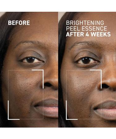 Dr. Brandt Dr. B Lab Brightening Peel Essence - Evens Skin Tone Smooths Skin Texture & Improves Radiance - 3.4 fl oz 3.4 Fl Oz (Pack of 1) - Buy Online on GoSupps.com