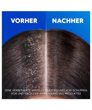 Head & Shoulders Apple Fresh 2in1 Anti-Dandruff Shampoo 800ml - Up to 100% Dandruff Protection Clinically Tested for All Hair Types Daily Freshness International Shipping Available - Buy Online on GoSupps.com