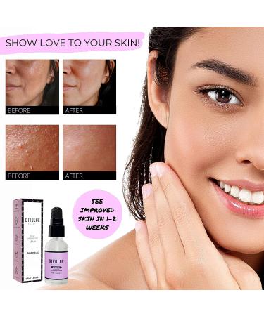 Divulge Beauty AHA Mandelic Acid Gel Serum | Daily Exfoliating Treatment for Acne Scars, Dark Spots & Hyperpigmentation on Face, Back, Thighs, Arms, Chest & Butt | 1 oz - Buy Online on GoSupps.com