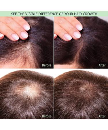 Rice Water Hair Care Spray w/ Biotin for Growth & Repair - Women & Men - Moisturize, Strengthen, Thicken - Frizzy, Weak, Damaged Hair - Buy Online on GoSupps.com