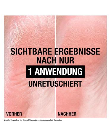 Neutrogena Norwegian Formula Cracked Heel Ointment 50ml | Best Foot Care for Dry Cracked Skin - International Shipping Available - Buy Online on GoSupps.com