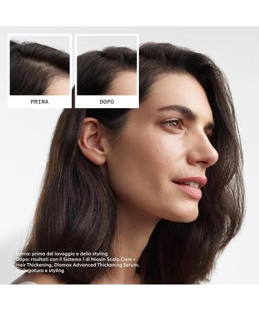 NOVA ENGEL Sistema 3 - Kit - Tratamiento Para Cabello Te Ido Con Debilitamiento Leve 3 U - Buy Online on GoSupps.com
