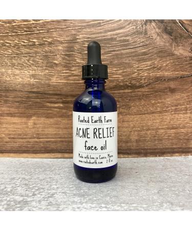 Acne Relief Face Oil | 2 fl oz Facial Serum & Moisturizer for Sensitive Skin - International Shipping Available - Buy Online on GoSupps.com