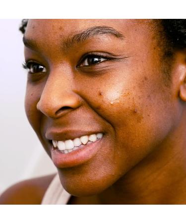 SVR - Cicapeel Sebiaclear - Anti-Imperfection 24-hour stop pimple and Anti-marks - For Sensitive Acne-Prone Skin - 15 ml Recycled Material Tube - Buy Online on GoSupps.com