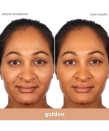 Almay Clear Complexion Acne Foundation Makeup - Lightweight Medium Coverage with Salicylic Acid | Hypoallergenic & Fragrance-Free for Sensitive Skin - 750 Golden, 1 fl oz - Buy Online on GoSupps.com