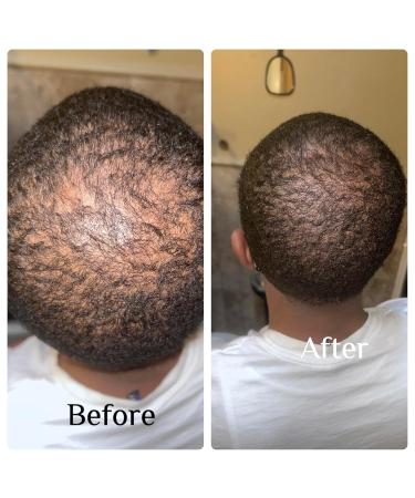 Sea Moss Collagen Hair & Skin Oil | Fenugreek Rosemary Nettle Ginseng Ylang for Hair Growth & Youthful Skin - Buy Internationally - Buy Online on GoSupps.com