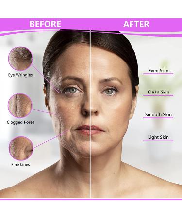 FDA Cleared LED Light Therapy Face Mask for Anti-Aging & Dark Spot Removal + Ice Roller - 8-in-1 Rejuvenation Device - Buy Online on GoSupps.com
