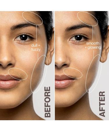 DERMAFLASH LUXE+ Device | Anti-Aging Exfoliation & Hair Removal Tool | Sonic Edge Technology | Seafoam - Get 4 Weeks of Treatment - Buy Online on GoSupps.com