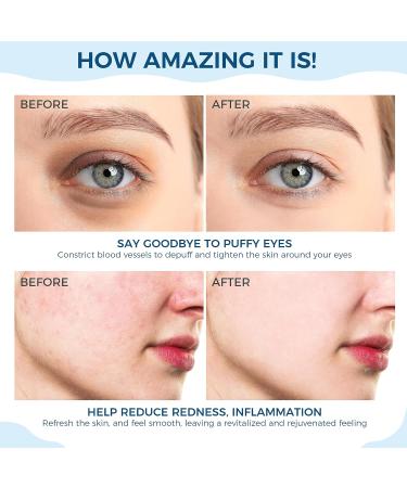 ZOMCHI Ice Roller for Face & Eye Puffiness Relief | Premium Massage Roller with Spare Roller & Hygienic Case - Relieve Fatigue Fast - Buy Online on GoSupps.com