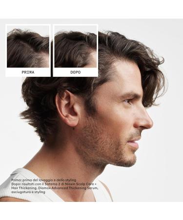 Nioxin Sistema 2 Kit Trifasico Shampoo 300ml Conditioner 300ml Treatment 100ml - kit amincissement avanc  - Buy Online on GoSupps.com