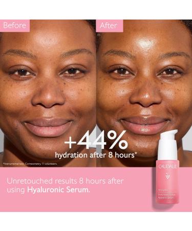 Buy Caudalie Vinohydra Hyaluronic Serum - Hydrating Skincare for All Skin Types | Fast International Shipping - Buy Online on GoSupps.com
