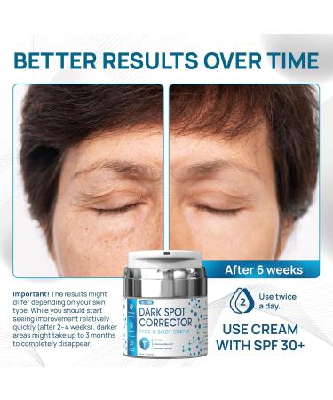 Dark Spot Corrector for Face & Body | Moisturizing Skin Lightening Cream with Collagen & Niacinamide | Hyperpigmentation Treatment for Legs Hands Thighs & Underarms - 1.85 fl oz - Buy Online on GoSupps.com