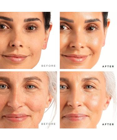 NEW LOOK Tree of Life Vitamin C & Retinol Serum Duo - Glowing & Revitalizing Skin - 1 Fl Oz (2 Pack) - Buy Online on GoSupps.com