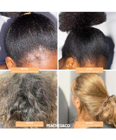 .Hair Growth Oil! With Rosemary Oil Avocado Oil Castor Oil Jojoba Oil Camellia Oil and Vitamin E | 100% Natural Hair Oil | Effective Treatment - Buy Online on GoSupps.com